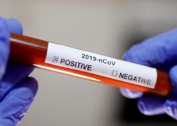 Dinkes Kerinci Kesal Hasil Rapid Test Tak Kunjung Dilapor KPU