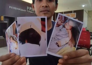 Diberi Tahu Malah Ngeyel, Perawat RS Potong Jari Tangan Bayi hingga Putus, Keluarga Mau Damai Asalkan Rp500 Juta